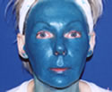 Obagi Blue Peel