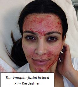 The Vampire facial helped Kim Kardashian
