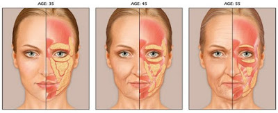 facial-fat-pads