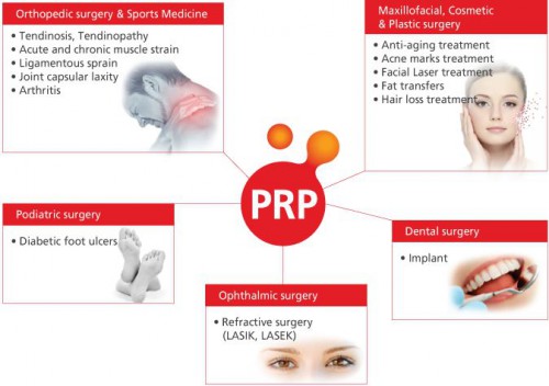 PRP treatments for skin care